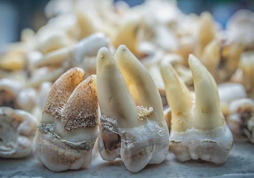 Prevent Tooth Decay: Recognize and Treat Dental Caries Early
