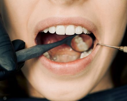 Effective Ways to Manage and Prevent Gum Sensitivity at Home